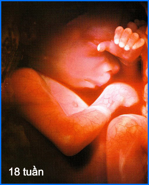 18weeks3